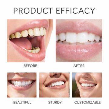 Zevorex Instant Whitening Strips
